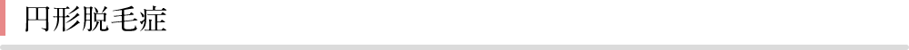 円形脱毛症