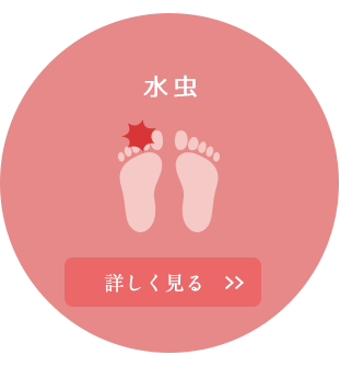 水虫・巻き爪